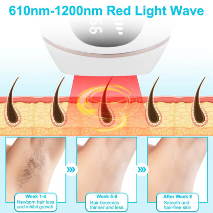Laser Hair Removal