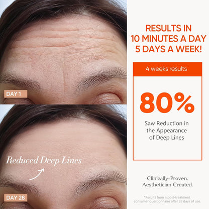 Cordless LED Face Mask for Wrinkle & Acne- Black