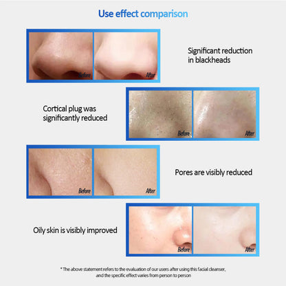 Rechargeable Gentle Face Exfoliator