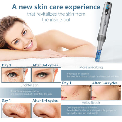 Electric Microneedle Derma Roller Pen -Grey