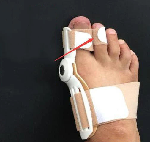 Bunion Splint Big Toe Corrector