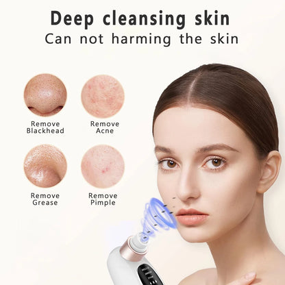 Deep Cleaning  Black Head Remover