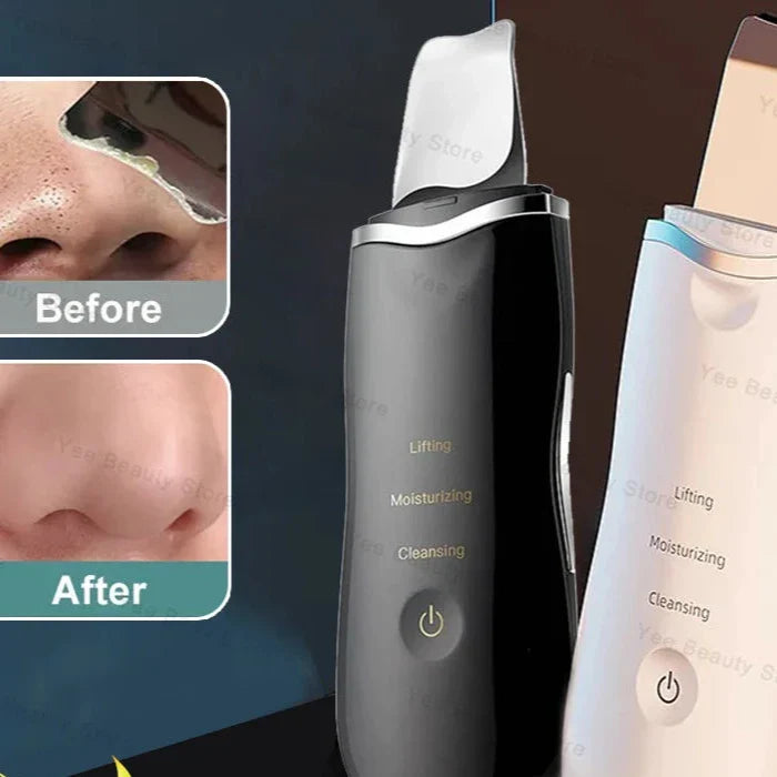 Skin Peeling Machine