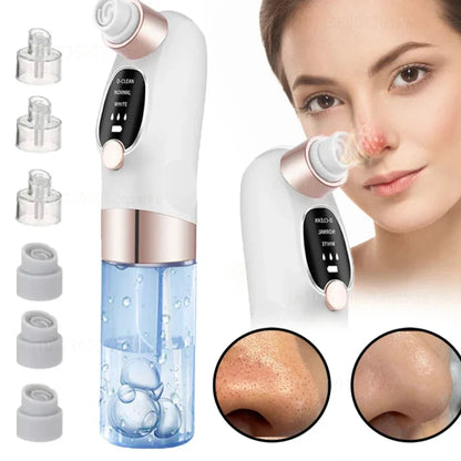 Deep Cleaning Black Head Remover