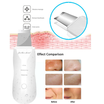 skin Peeling Machine