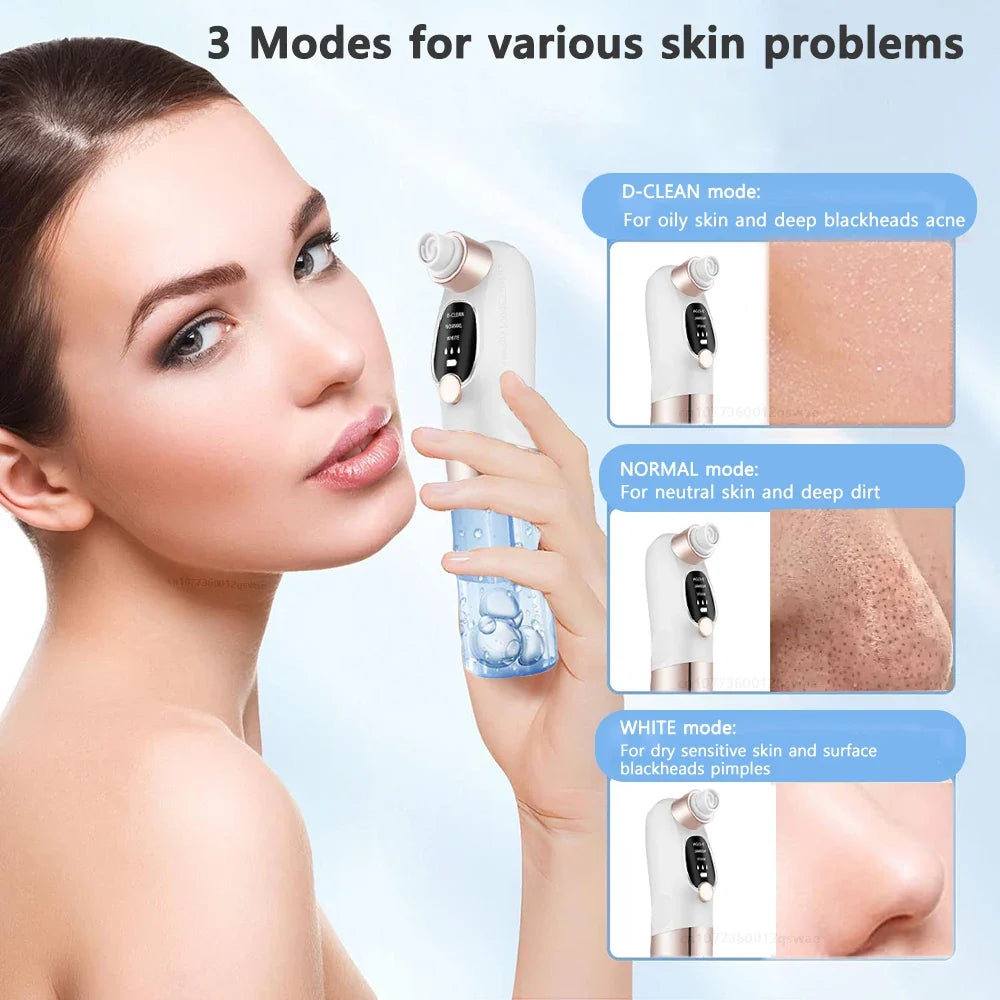 Deep Cleaning Black Head Remover
