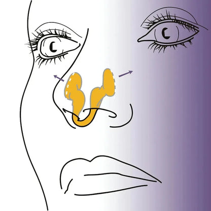 2pcs Mini Stop Snoring Device