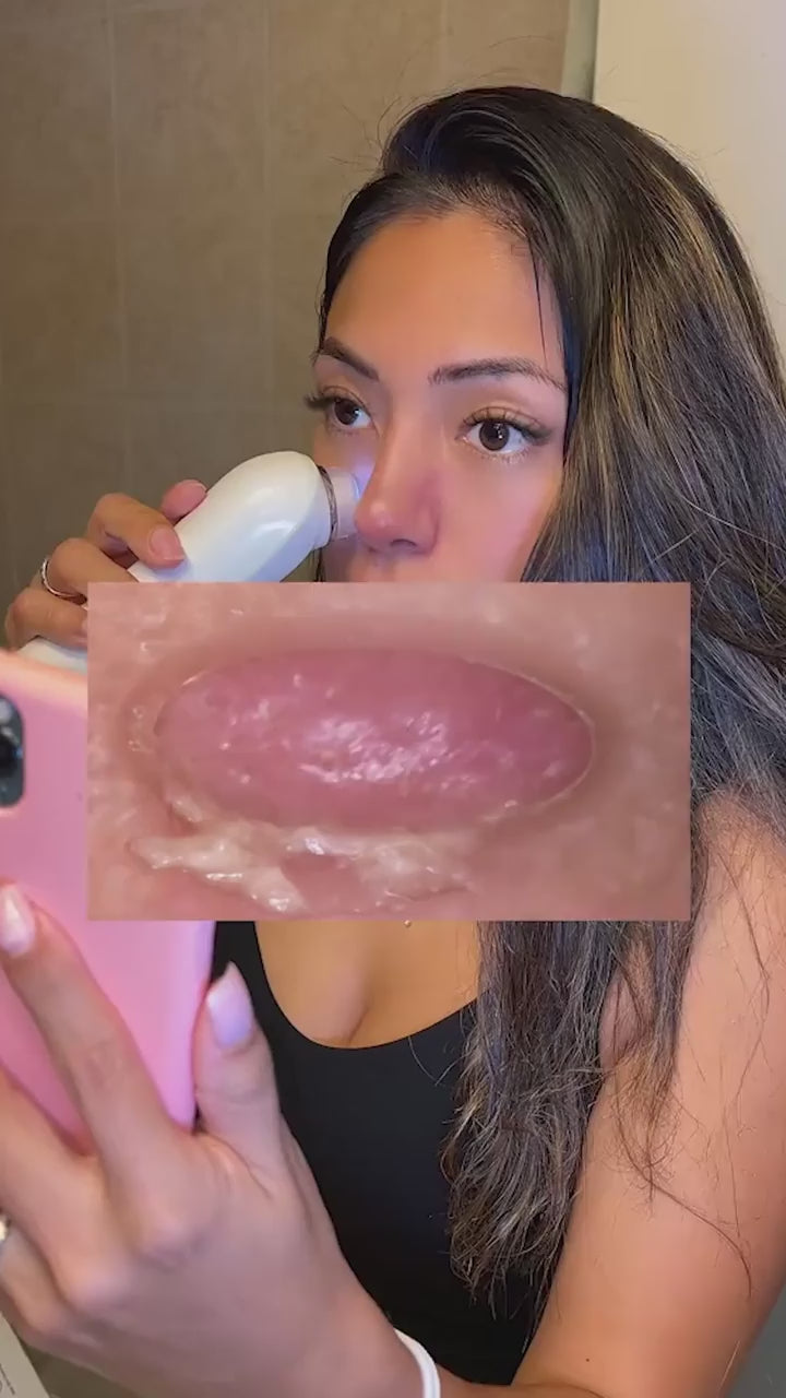 Deep clean black head remover.mp4