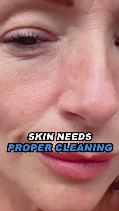 Skin Peeling Machine